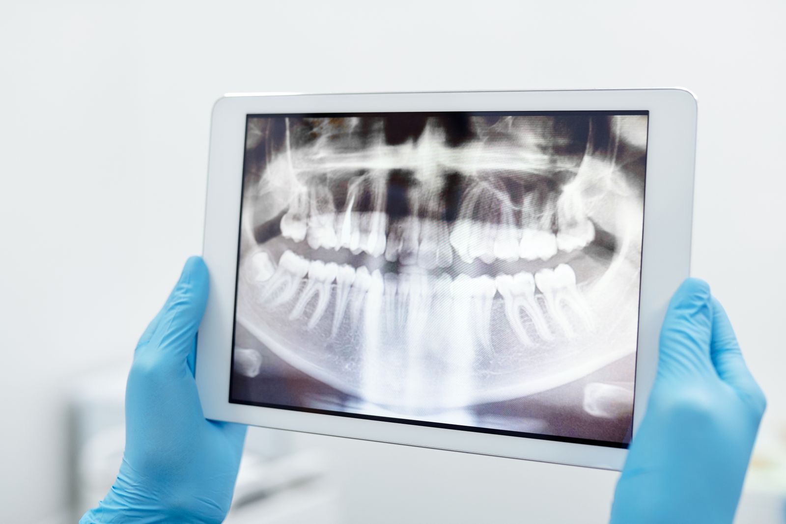 Tablet exibindo uma radiografia panorâmica dos dentes